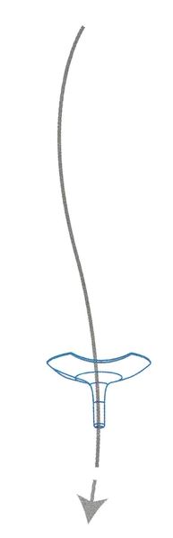 Artikelbild für Action Disc 6Stck. SB im Baltic Kölln Onlineshop